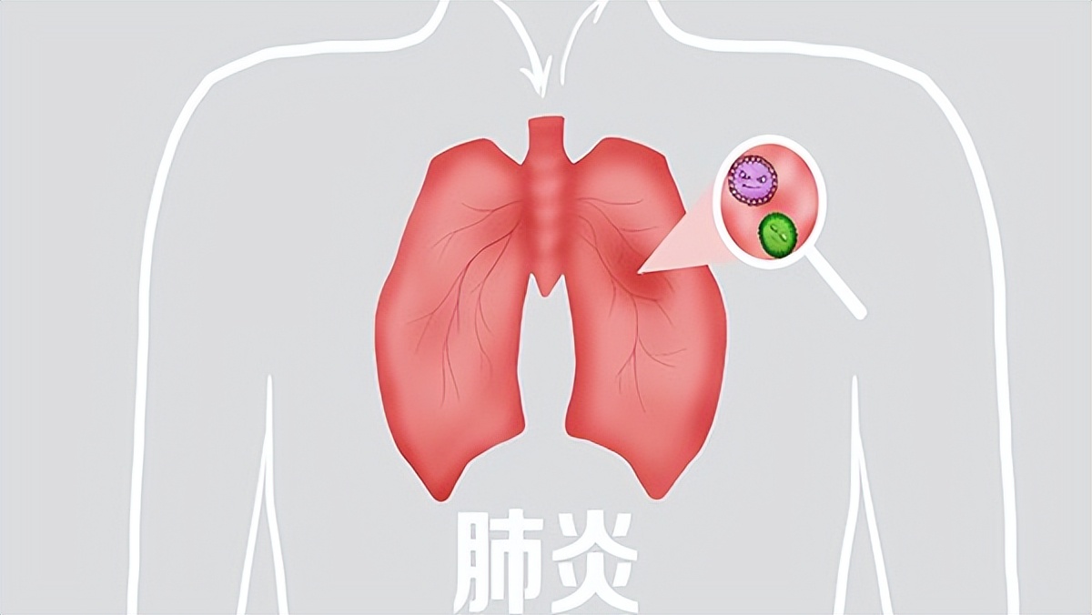 新生儿动脉导管未闭怎么治疗最好,新生儿动脉导管未闭怎么治