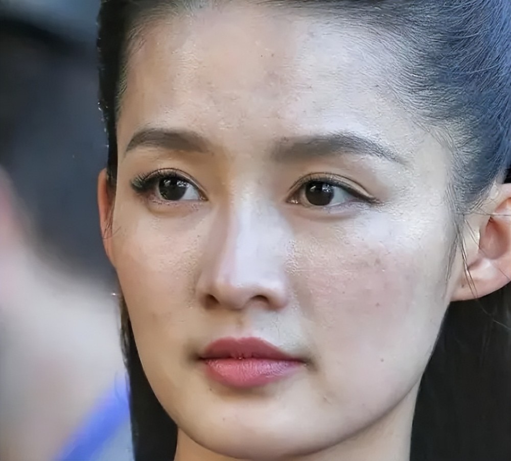 脸上有痘坑的明星,脸上爆痘特别多还好看的明星