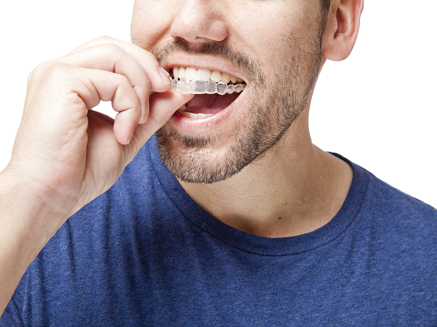 Artsmile小科普｜戴了牙套后你需要了解的8个细节