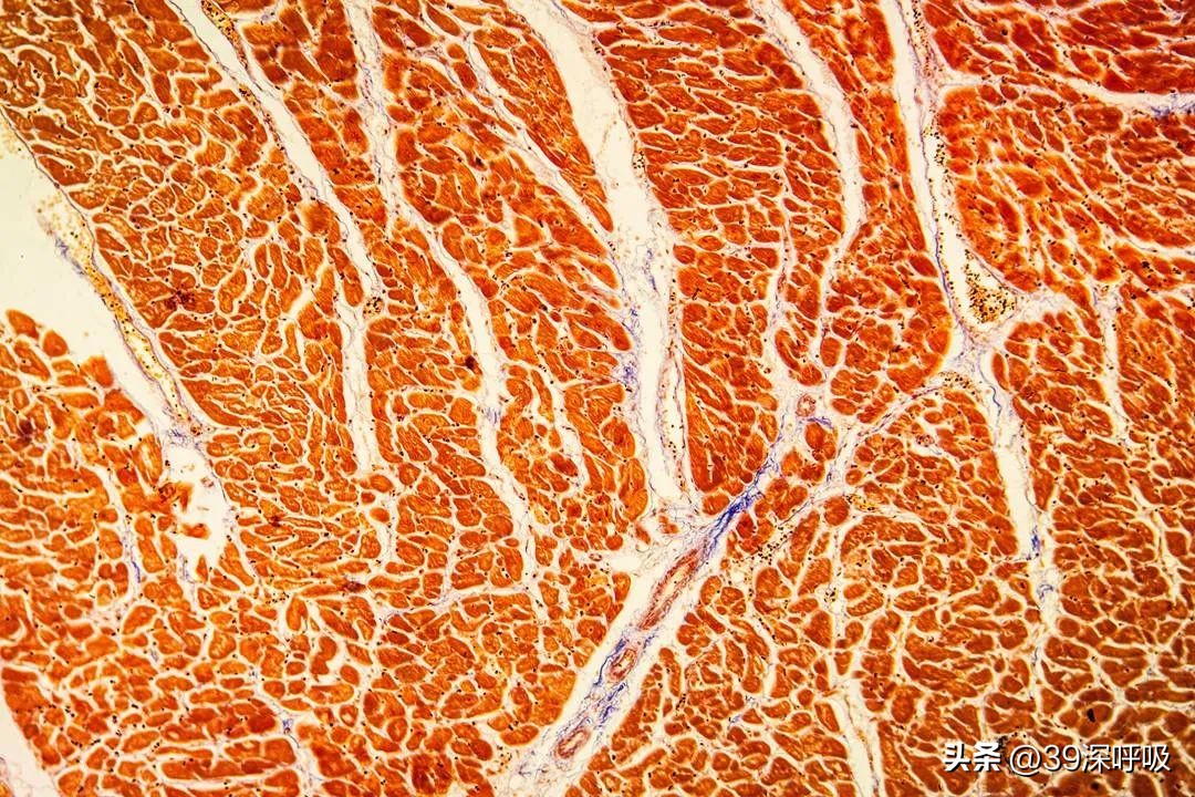 阳康后还会出现全身酸痛吗,阳康后身体会酸痛正常吗