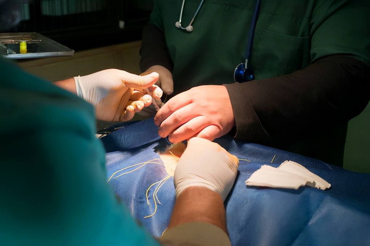 包皮过长容易导致妇科病怎么清洗,包皮过长会不会引起妇科病