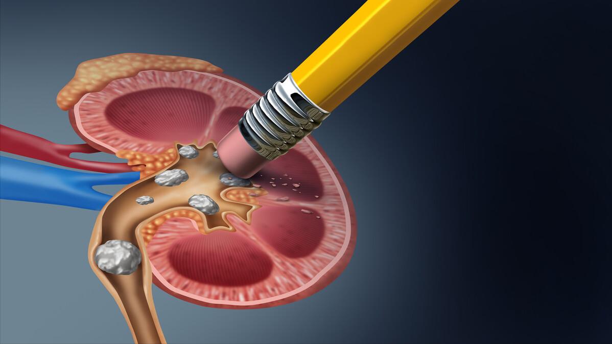 肾积水是会造成什么后果,肾积水能引起什么后果