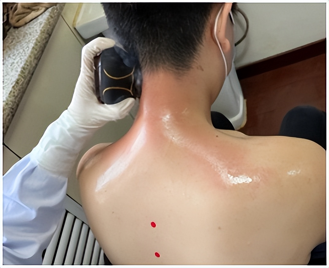 阳过之后肩关节疼痛,阳过以后腰腿酸疼