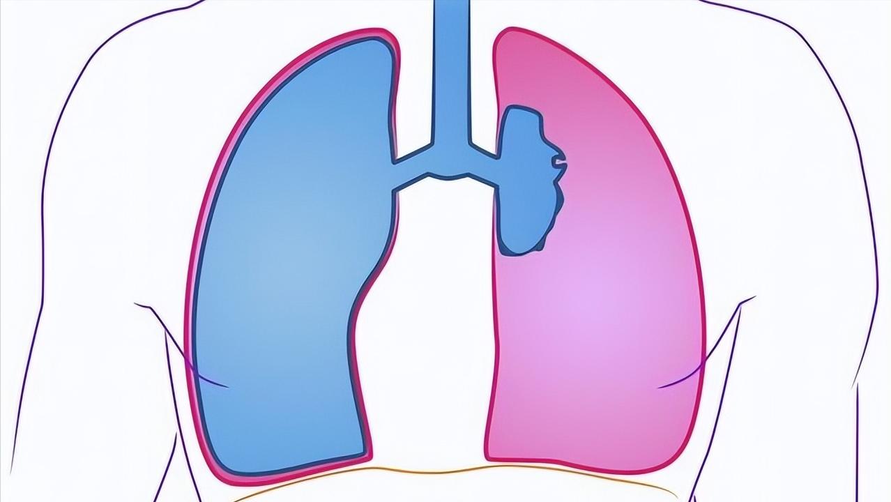 得了肺大泡怎么办,体检有肺大疱