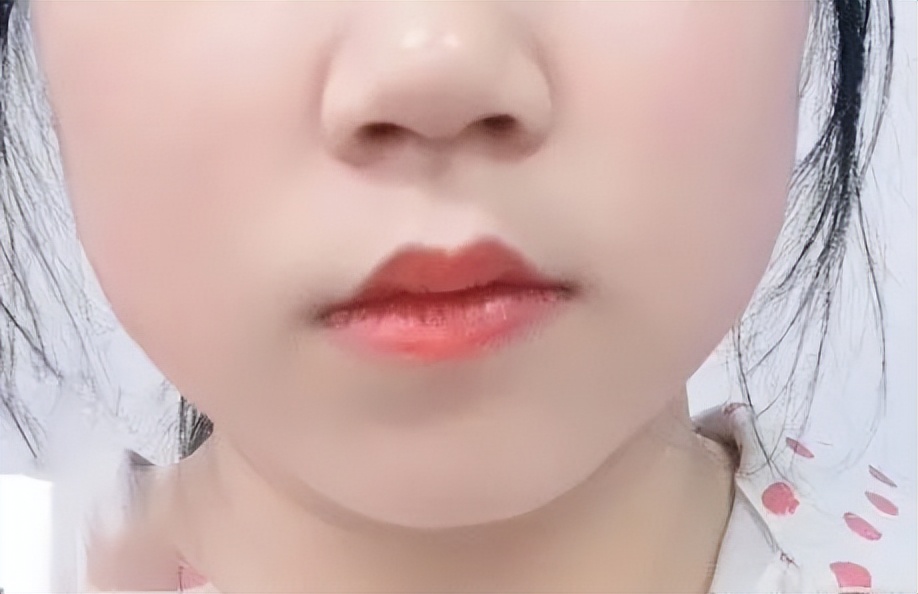 精致小脸的10个方法,精致脸如何变美
