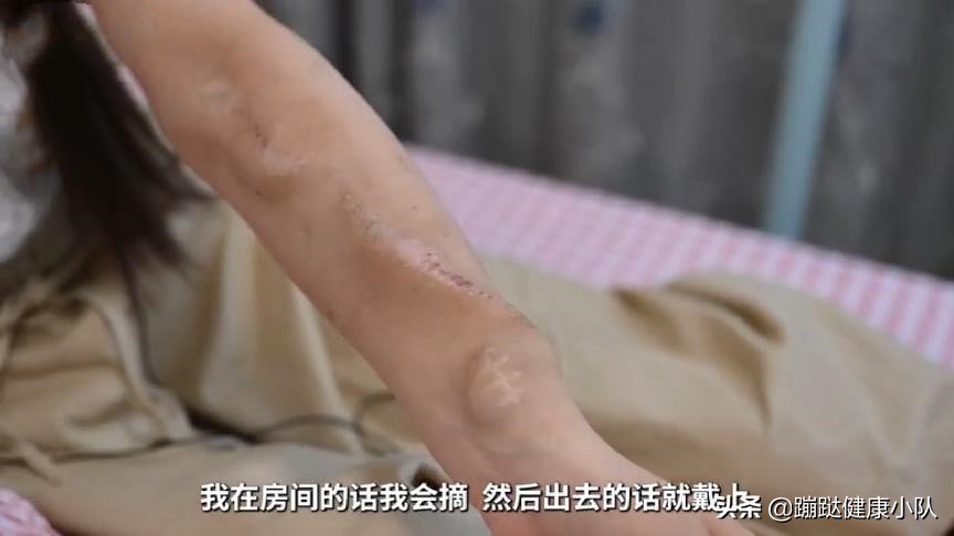 尿毒症女孩被父母抛弃男朋友照顾,19岁女孩尿毒症被亲生父母抛弃