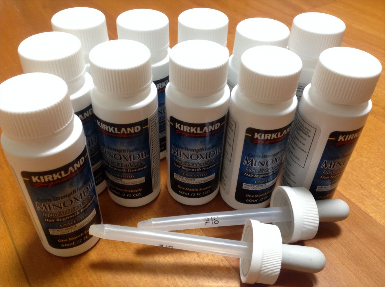 米诺地尔真的能治脱发,米诺地尔真的能够治好脱发吗