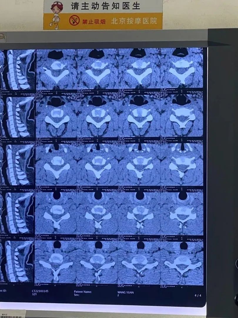 在北京，年轻人开始去按摩医院做能走医保的按摩了