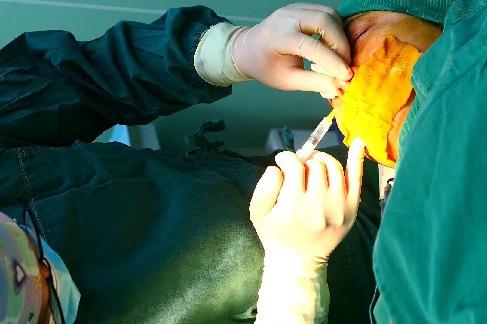 整形隆鼻手术,隆鼻整形全麻手术全过程