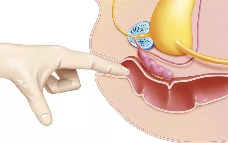 医院哪些检查令人尴尬,医院最尴尬的检查项目