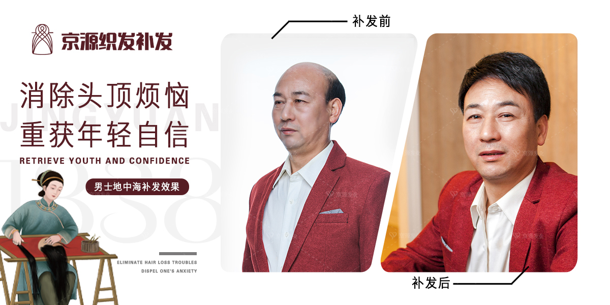 男式短发假发哪里好,长沙男士假发推荐排行榜