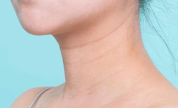 脸部皱纹分很多种，第一显老的是它？来看看如何“对症下药”