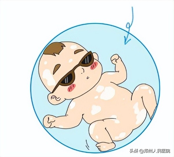 青记、马牙、假月经？别慌！新生儿这些情况都正常