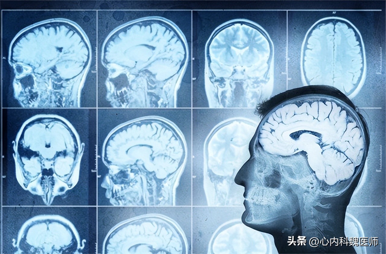 什么叫磁共振检查需要多少时间,磁共振水成像检查需要注意什么