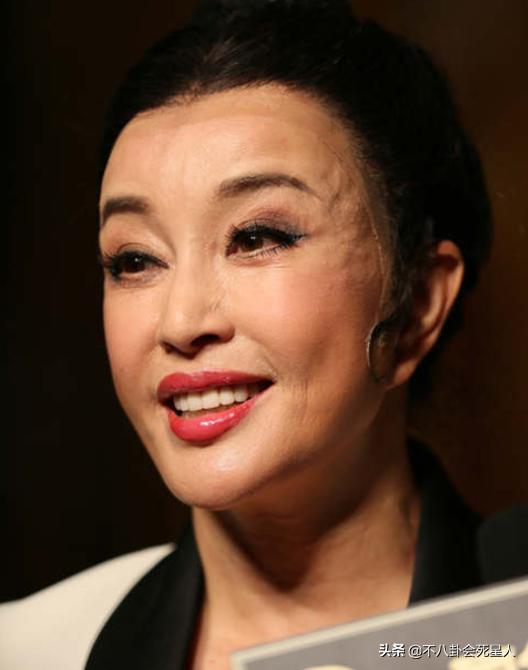 哪个女明星整容脸部变僵硬,整容脸vs自然脸的明星老去