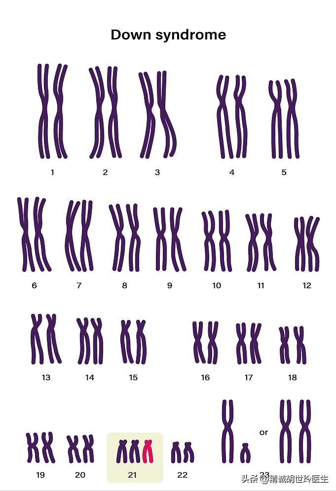 胚胎染色体异常生下胚胎有用吗,胚胎染色体异常会导致无法着床吗