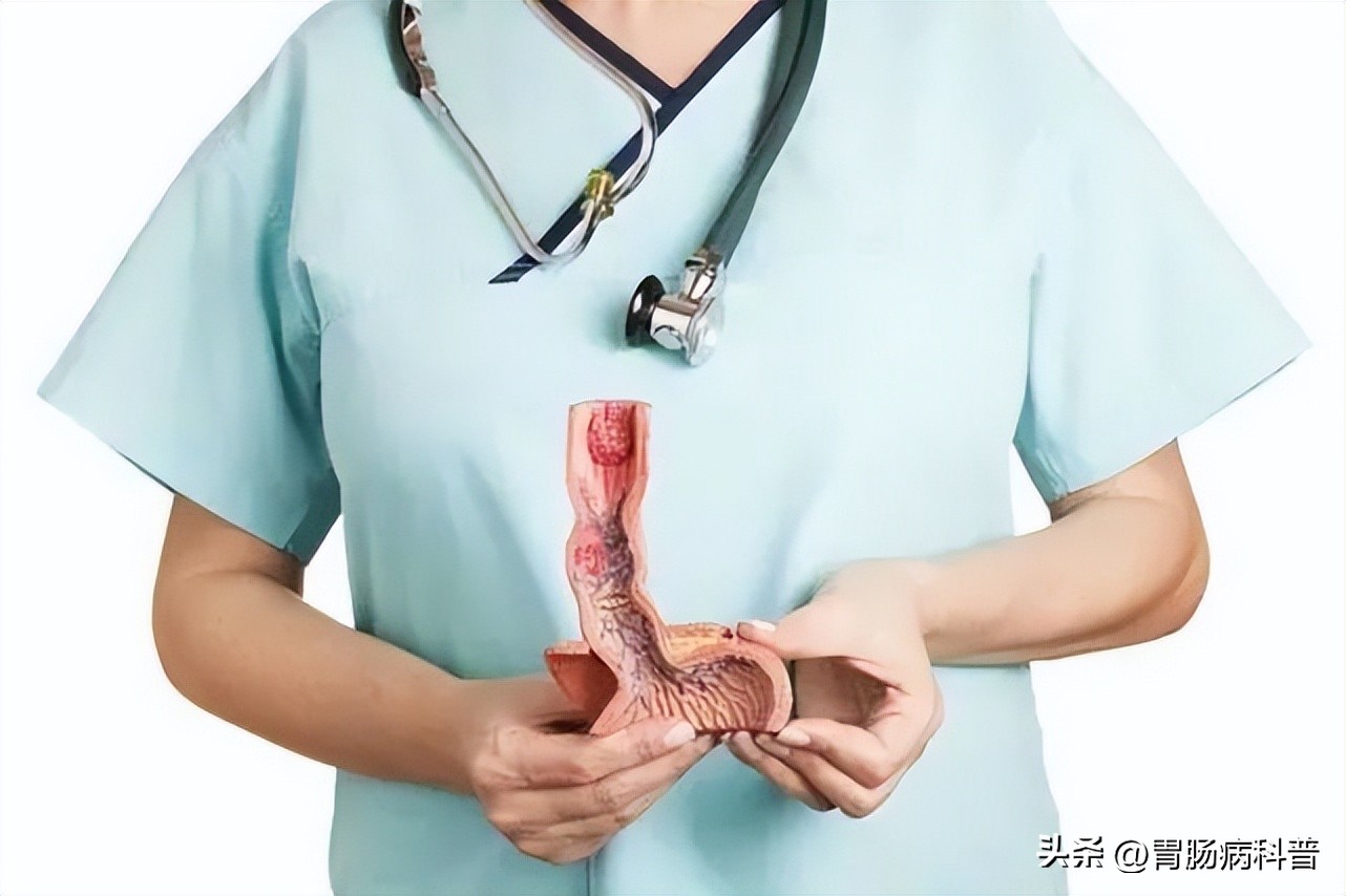 barrett食管炎和反流性食管炎,庆大普鲁卡因b12治反流性食管炎吗