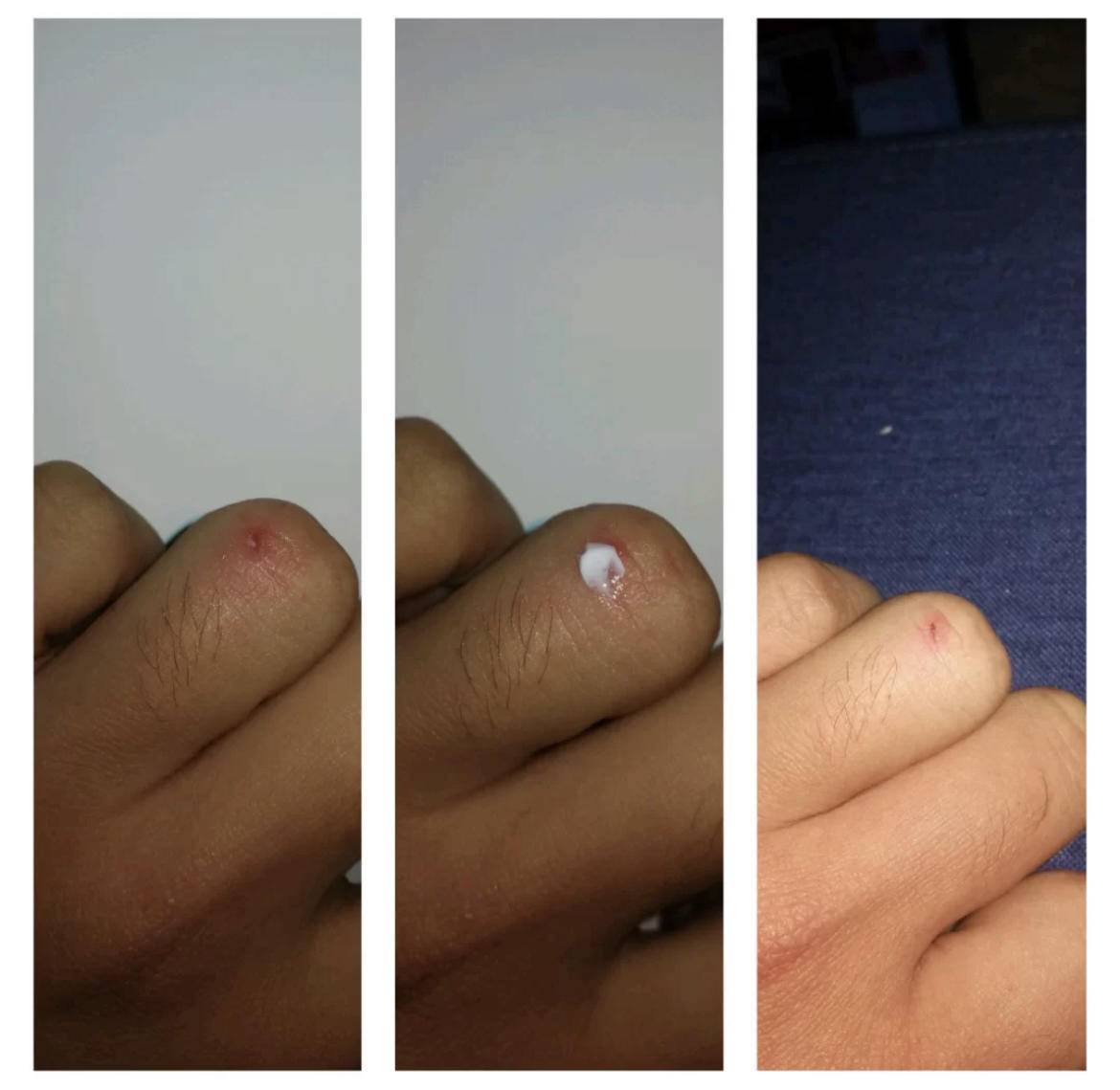 用了护肤品皮肤刺痛是缺水吗,护肤刺痛缺水怎么回事