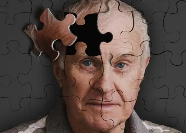 大脑开始萎缩有什么症状,大脑萎缩会有哪些反应