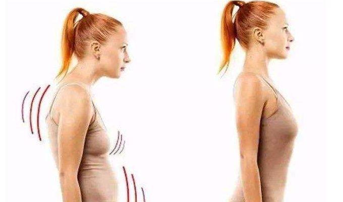 脊柱侧弯保守治疗可以报销吗,脊柱侧弯手术15万能报销多少