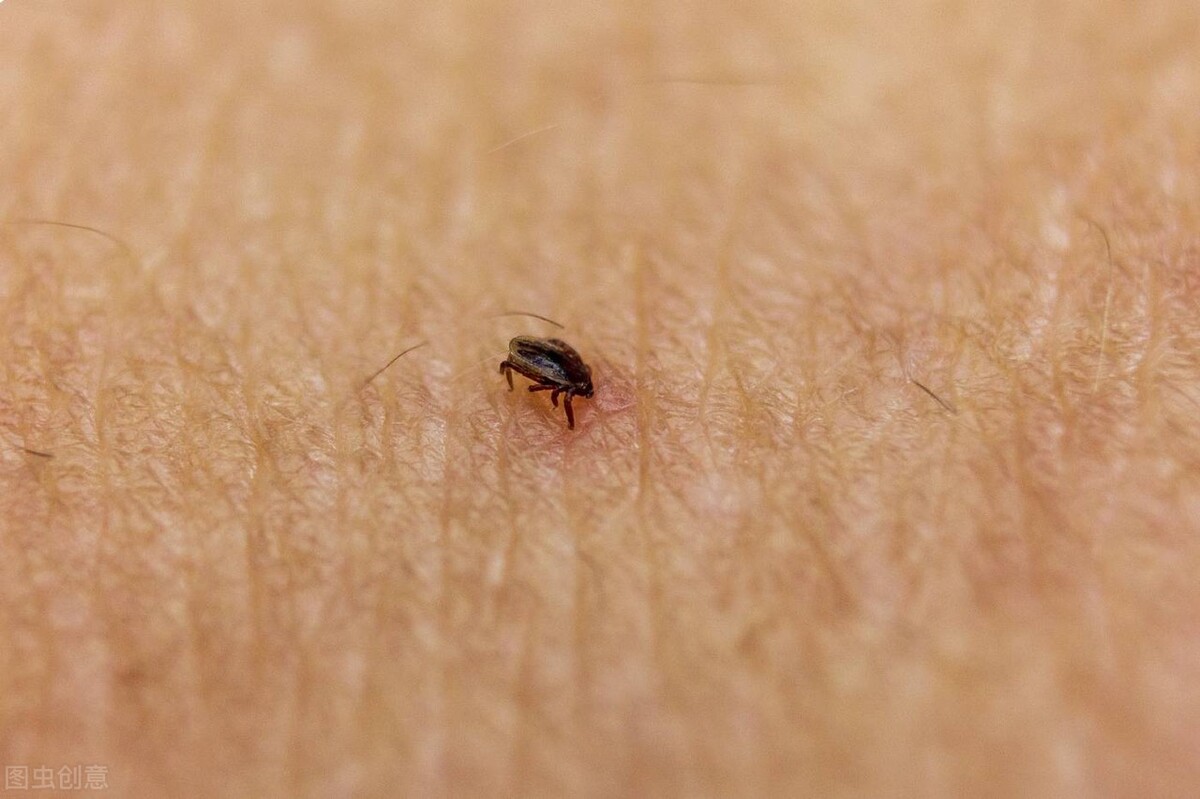 夏季来临，被跳蚤、蜱虫感染后要怎么办？铲屎官们看过来