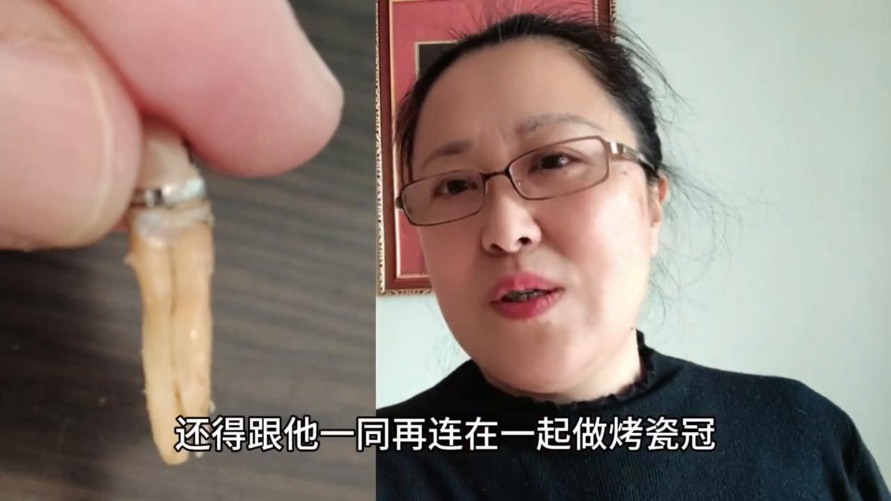 不同医院的同一品牌全瓷牙,牙齿隐裂牙神经挑好还是不挑好