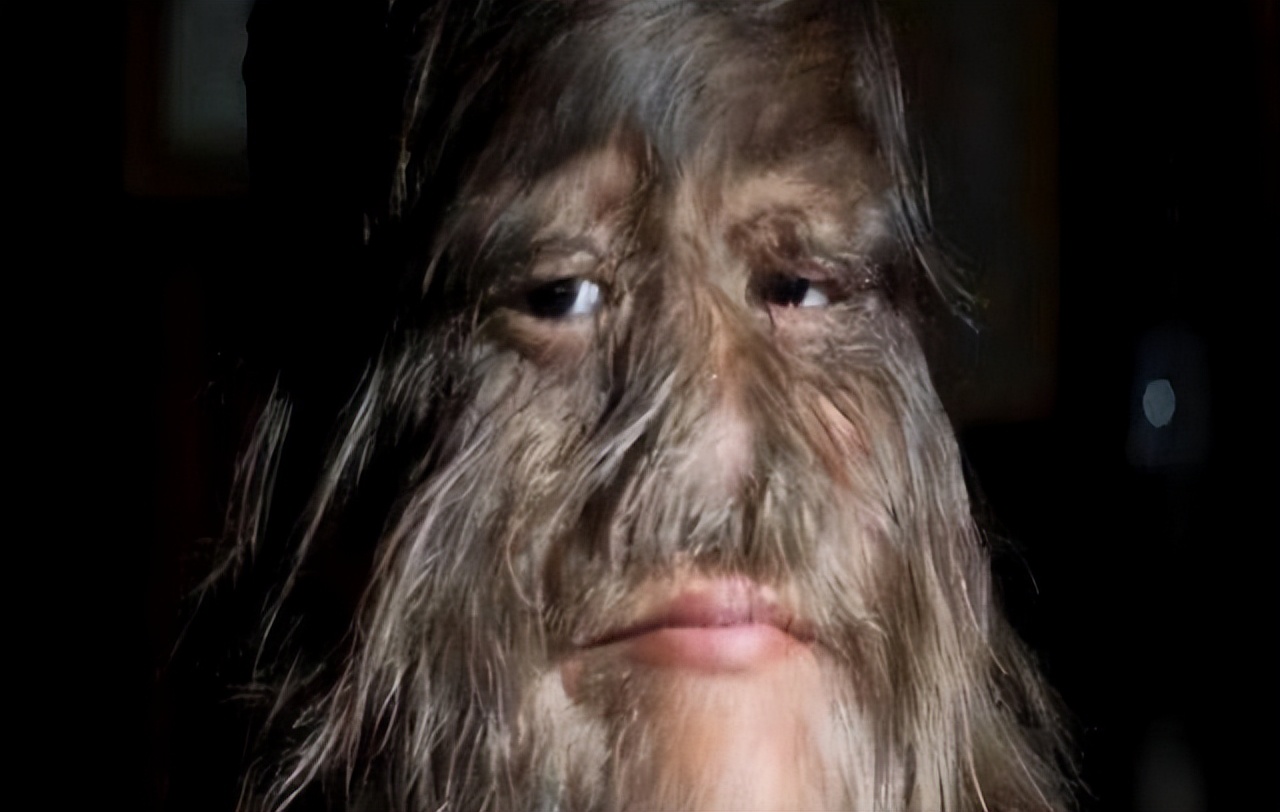 光子和脱毛谁更痛,光子与脱毛仪一样吗