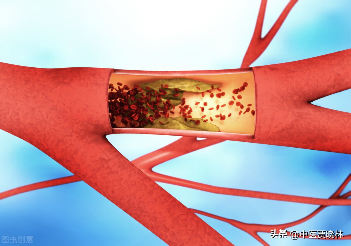 气血不足吃什么中成药补气血,女人气血虚弱吃什么中成药补气血