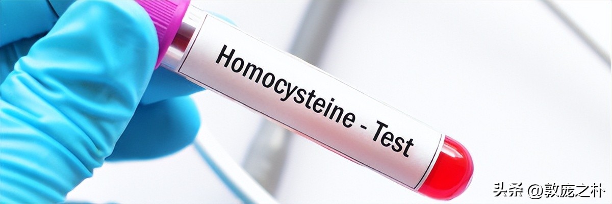 为什么会产生很多同型半胱氨酸 (为什么会出现同型半胱氨酸)