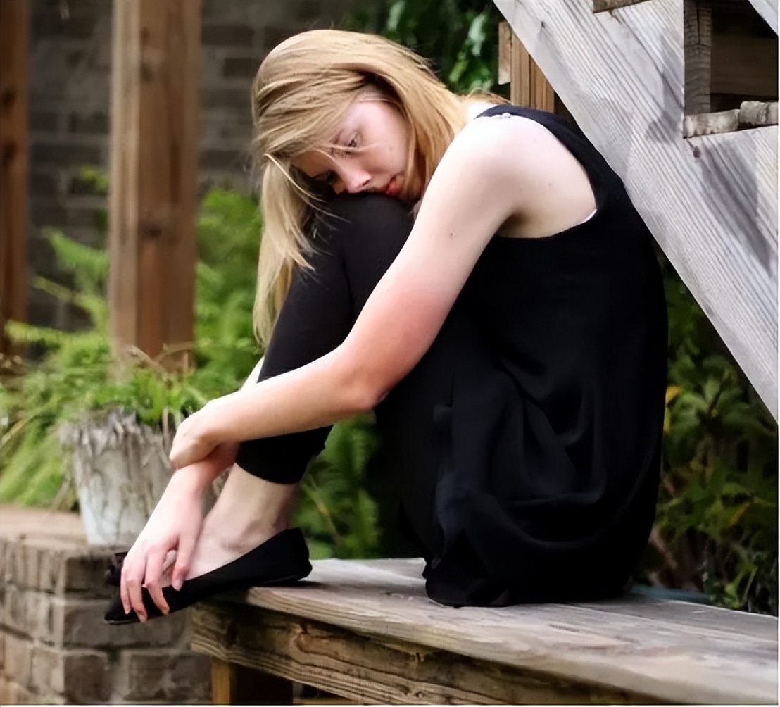 怎样治疗脱发掉头发最有效,掉头发怎么办教你一招永不脱发