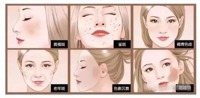 如何快速祛斑最有效方法,中药快速祛斑的有效方法