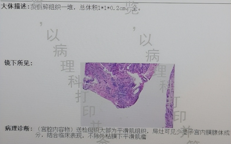 息肉是癌症的近亲,息肉是属于癌症吗