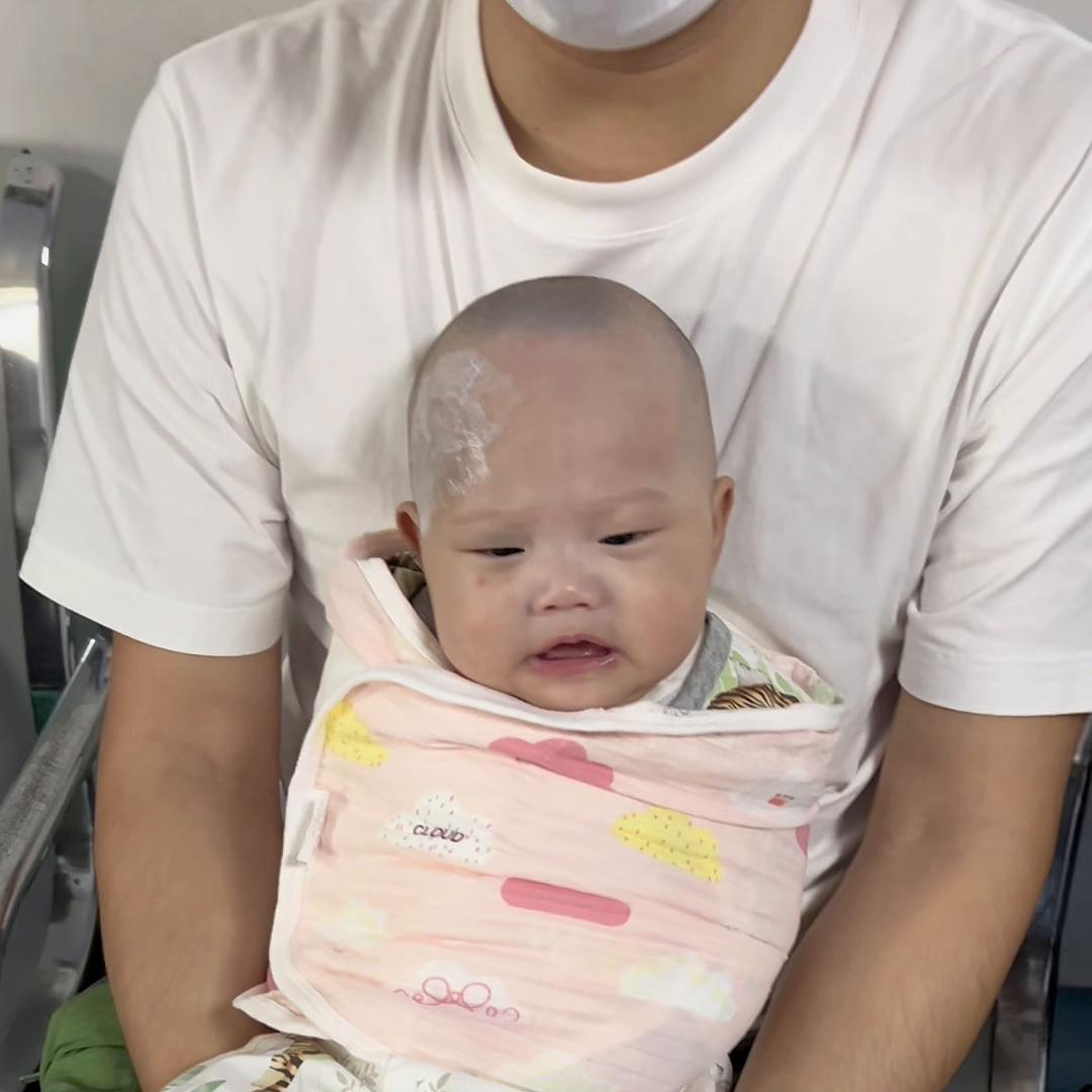 随手一个赞,长太田痣的宝宝