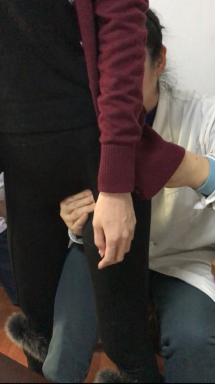 腰椎侧弯腰痛吃什么药,臀肌筋膜炎导致腰椎侧弯