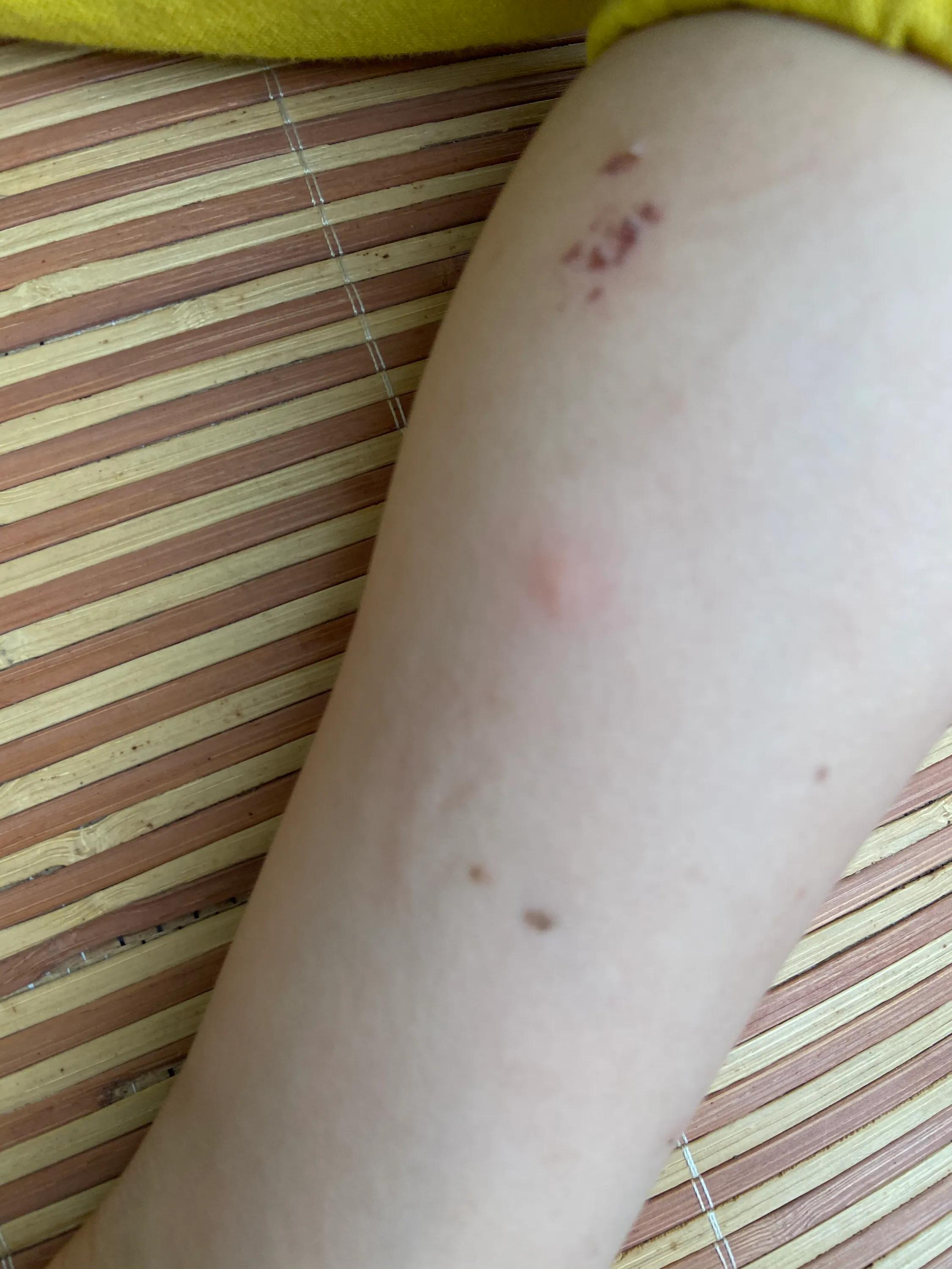 鏂伴矞鑹捐崏鑿栬挷,鑿栬挷鑹捐崏