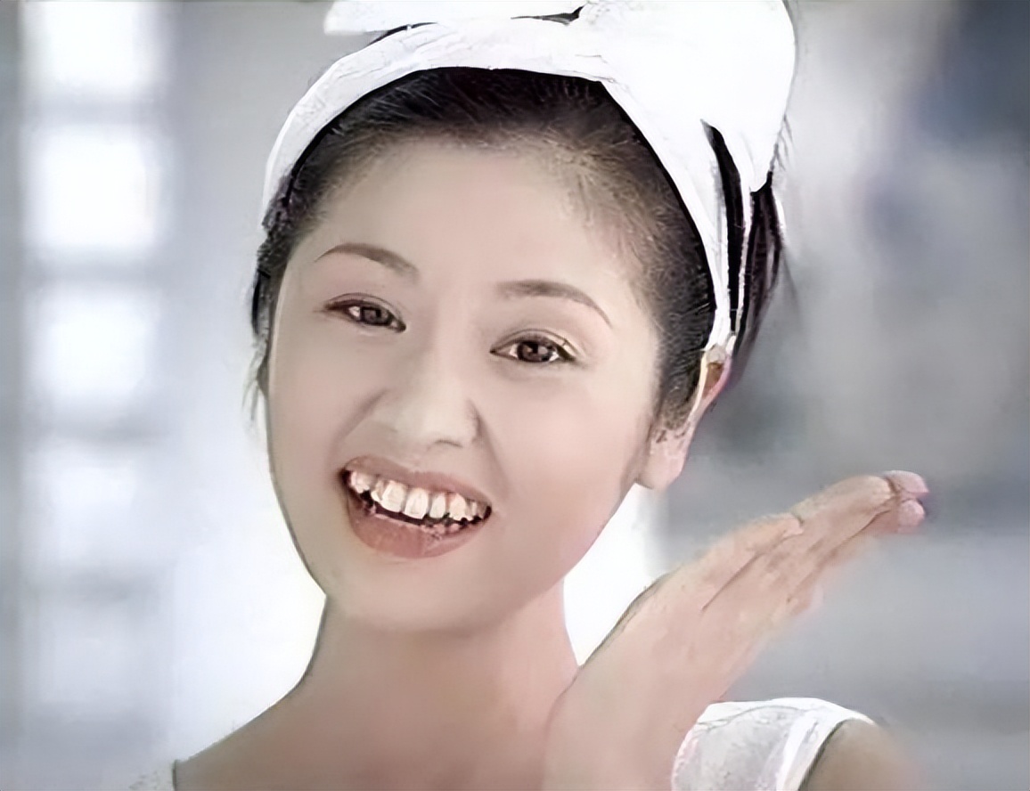 烤瓷牙牙龈发黑的明星,娱乐圈真的都是烤瓷牙吗