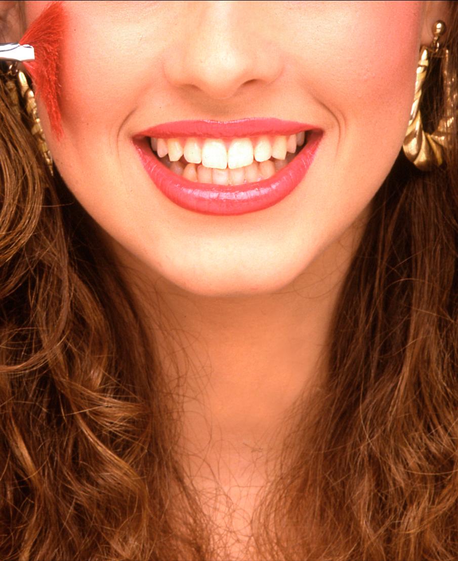 牙齿贴面的材料和品牌区别,牙贴面品牌十大排名最新