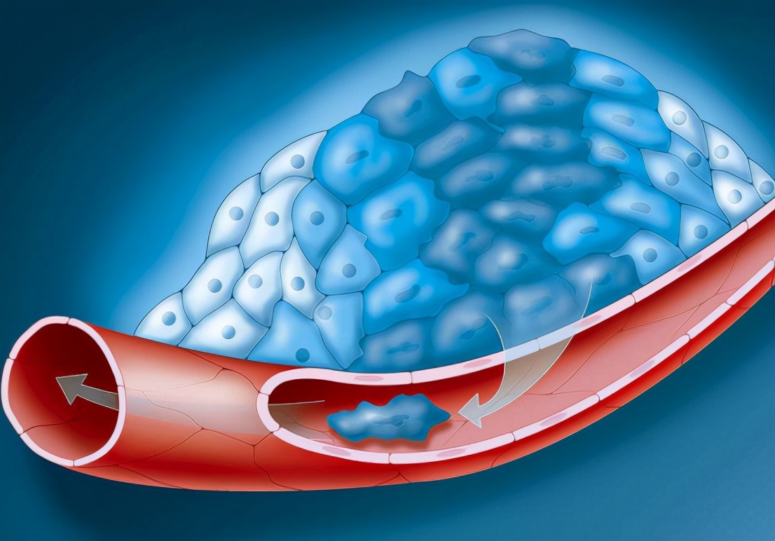 国产降压新药阿利沙坦酯,降压药阿利沙坦酯片的副作用