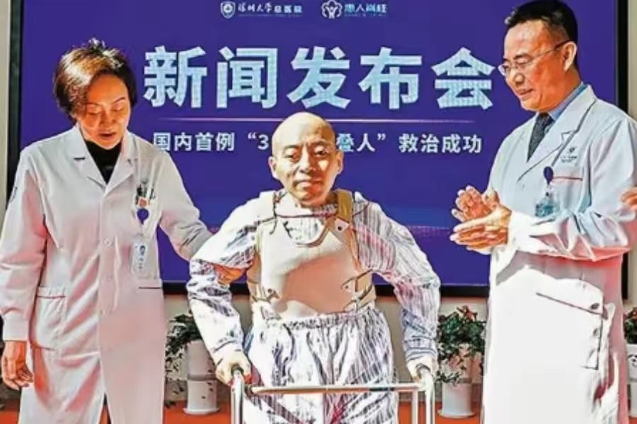 鎶樺彔浜烘潕鍗庤鏁叉柇鍚庨噸濉戠殑浜虹敓,鎵撳叆22鏍归挗閽夌殑鏉庡崕濡備粖鎬庢牱