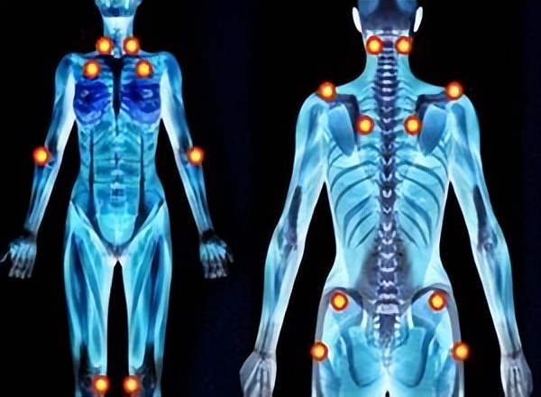 睡不好全身酸痛怎么回事,睡一觉全身都疼是什么原因