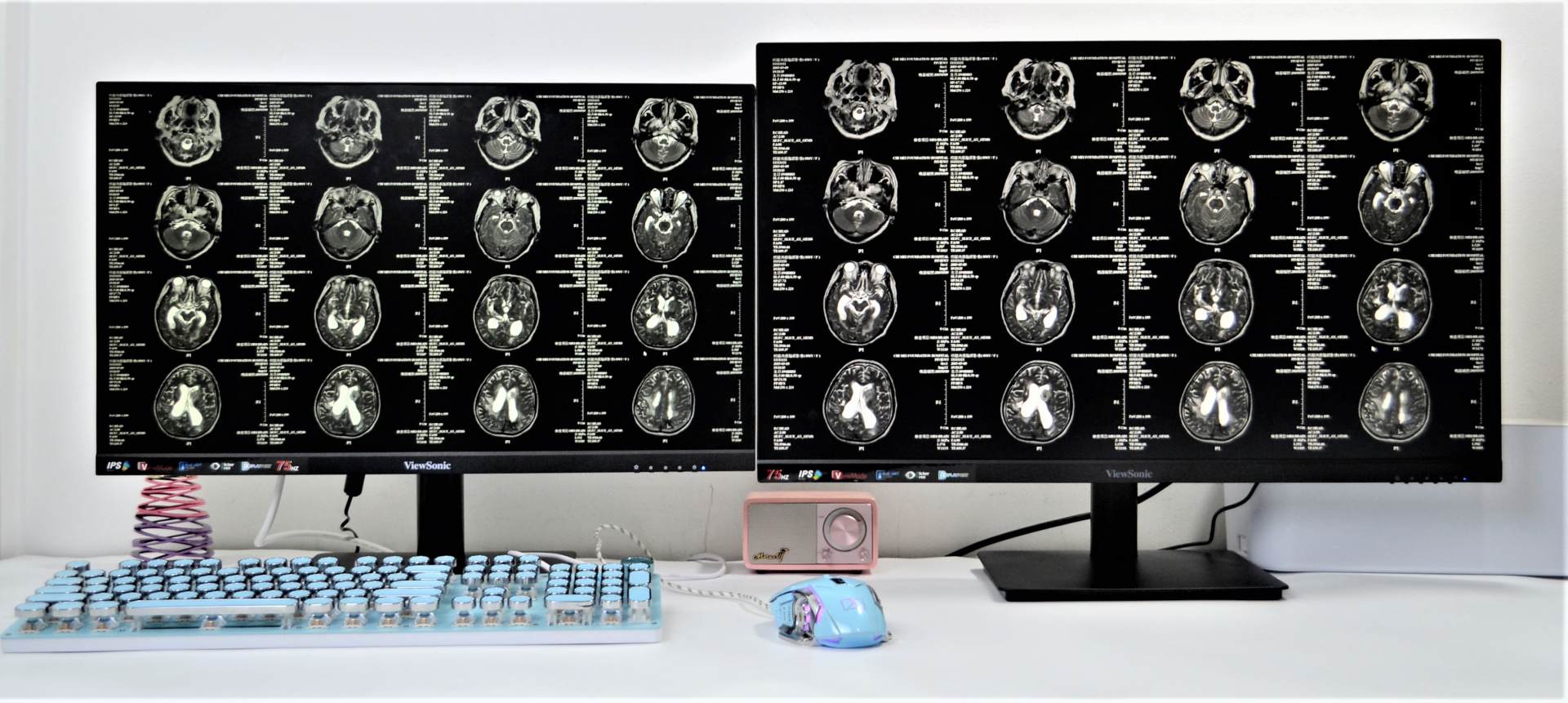 买多少寸的显示器适合打游戏,入门级24寸显示器性价比最高推荐