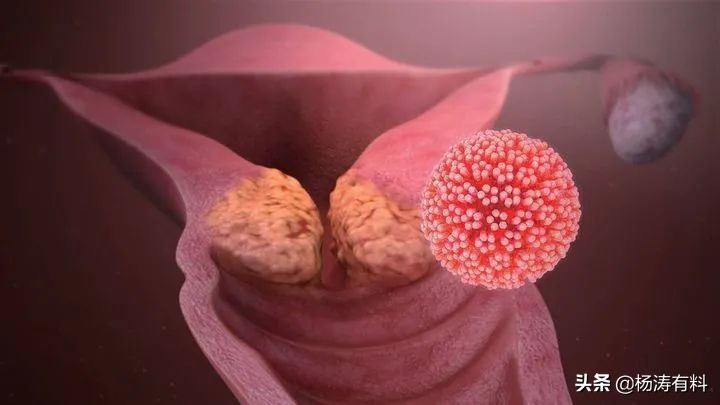 石家庄市政府民生实事项目,石家庄老旧小区电梯改造如何申请