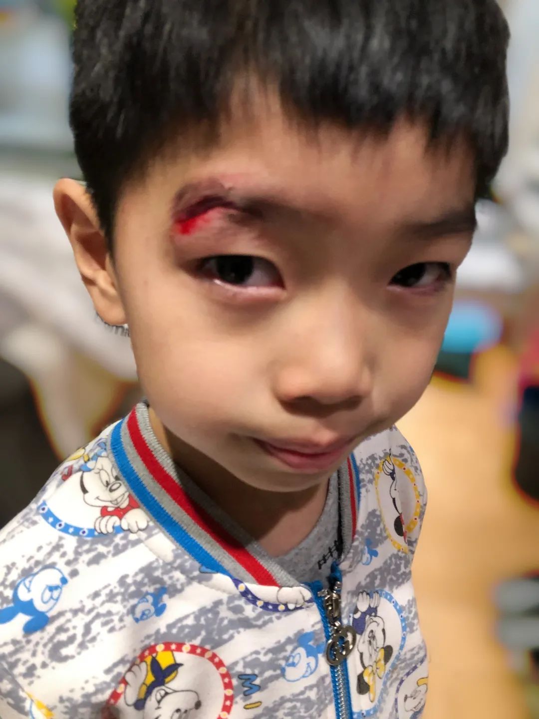 孩子磕碰到怎么安慰,小孩子划伤后有痕怎么处理