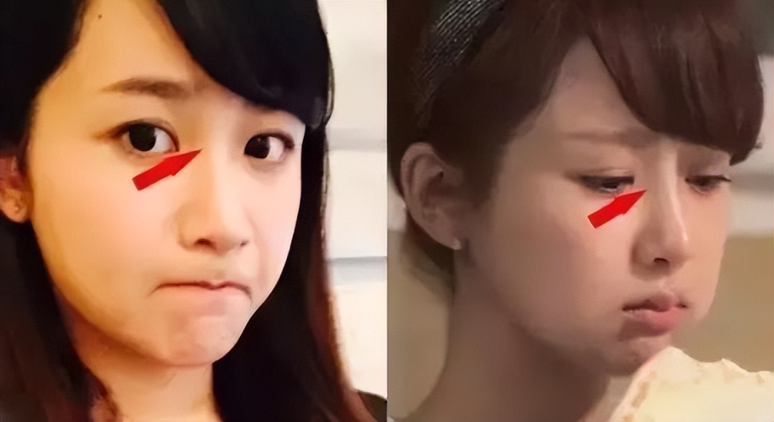 怎么不整容就能成为小v脸,不用整容也能变v脸吗