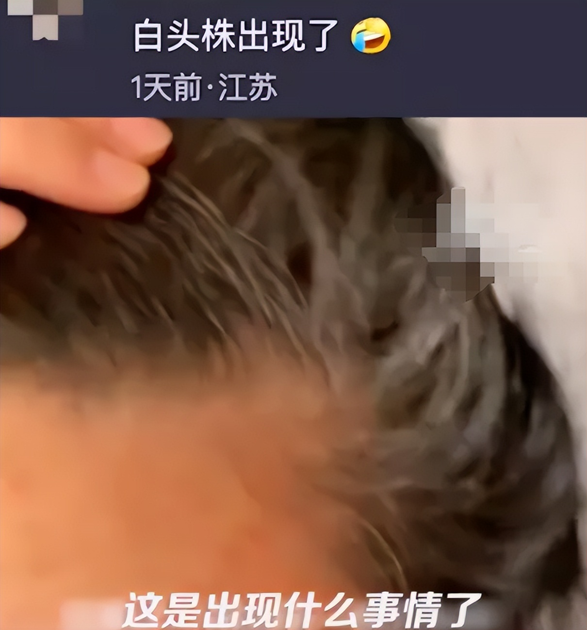 女子感染新冠后一夜白头,女子感染新冠黑发变白发