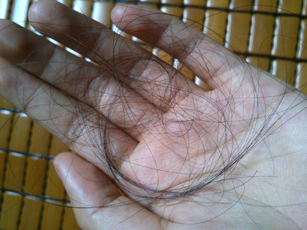 一女子坚持上海药皂洗头半年,上海女子硫磺皂洗头发半年效果