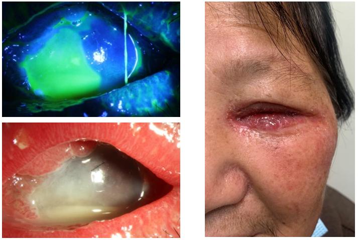 鐪肩鍖荤敓鍐簯,鍖楀尰涓夐櫌鐪肩涓撳鍐簯