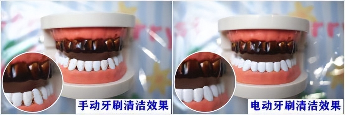 最好的电动牙刷品牌排行前十名,飞利浦sonicare3600系列电动牙刷