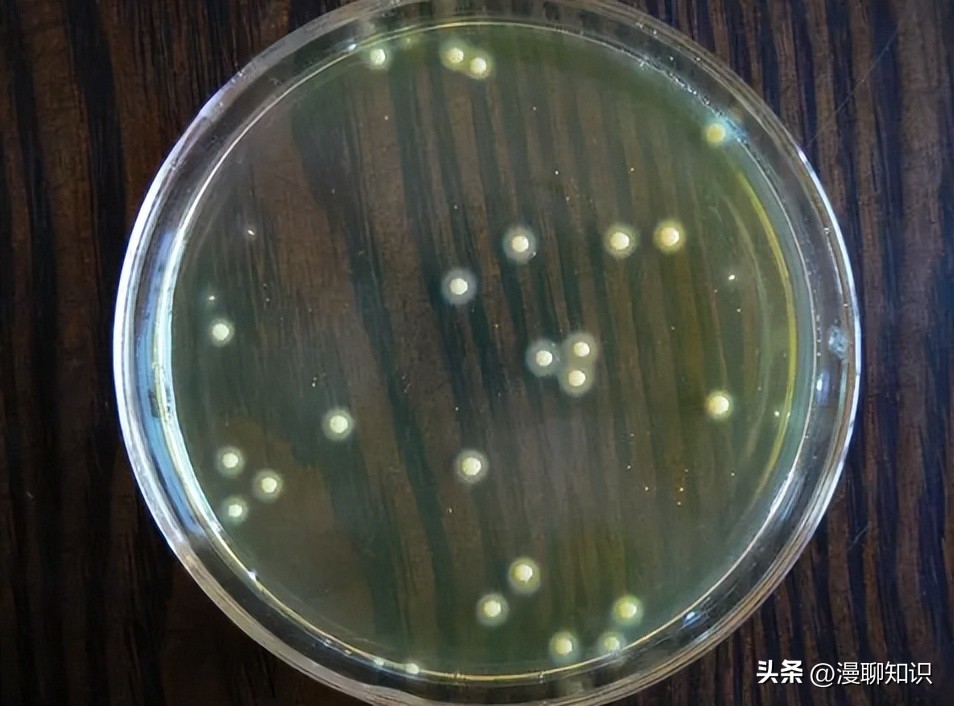 百毒杀对屏障系统灭菌率一般在64%~100%范围内,效果优于碘伏