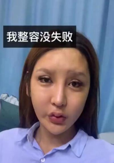 网红整容毁容真实案例,各大网红整容之后的后果